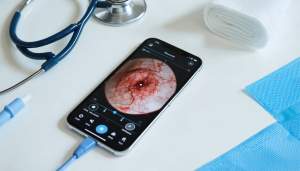 découvrez comment transformer votre smartphone en un dispositif innovant pour mesurer et évaluer précisément les plaies. simplifiez le suivi des plaies grâce à une technologie mobile pratique et accessible !
